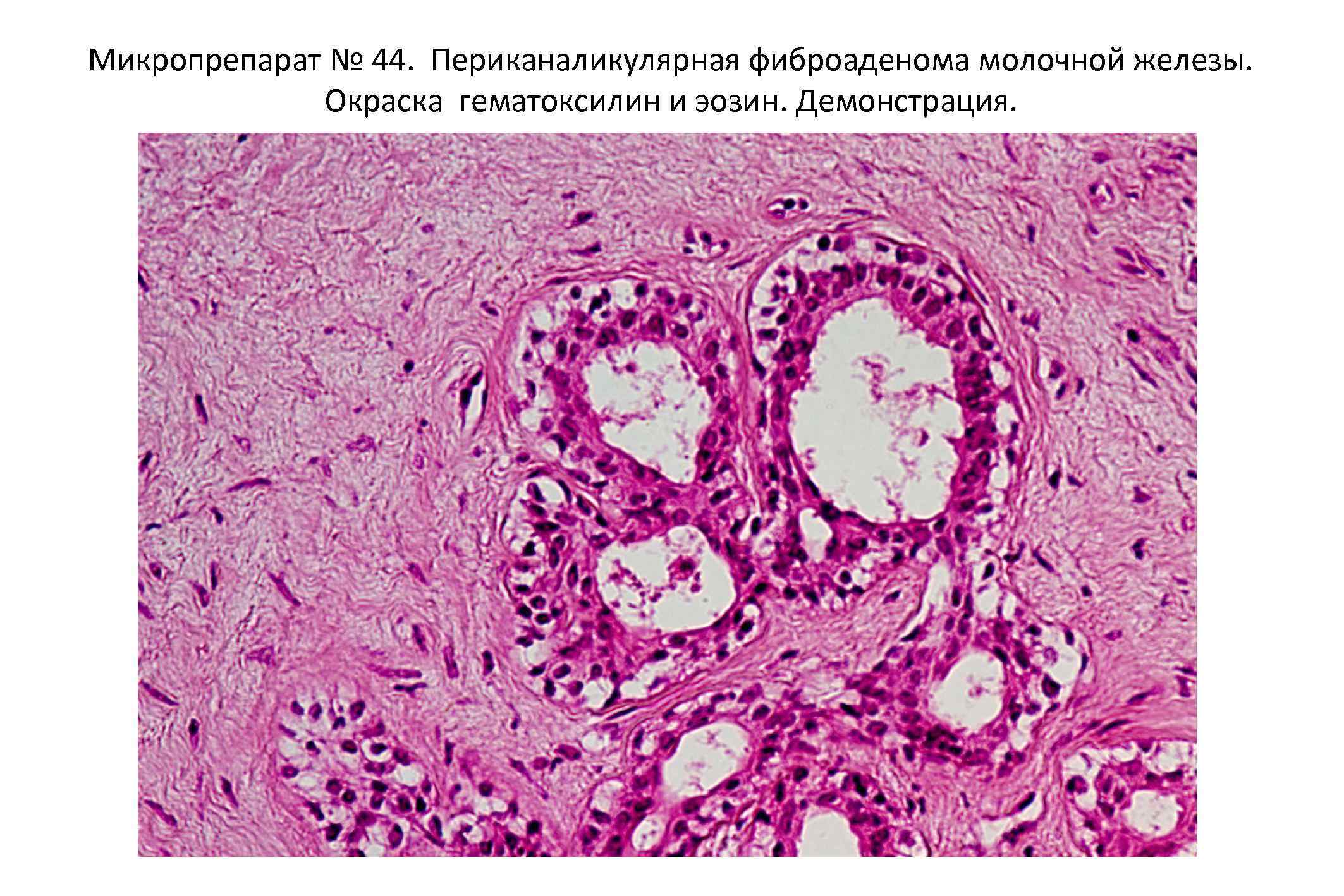 Гистология молочная железа рисунок