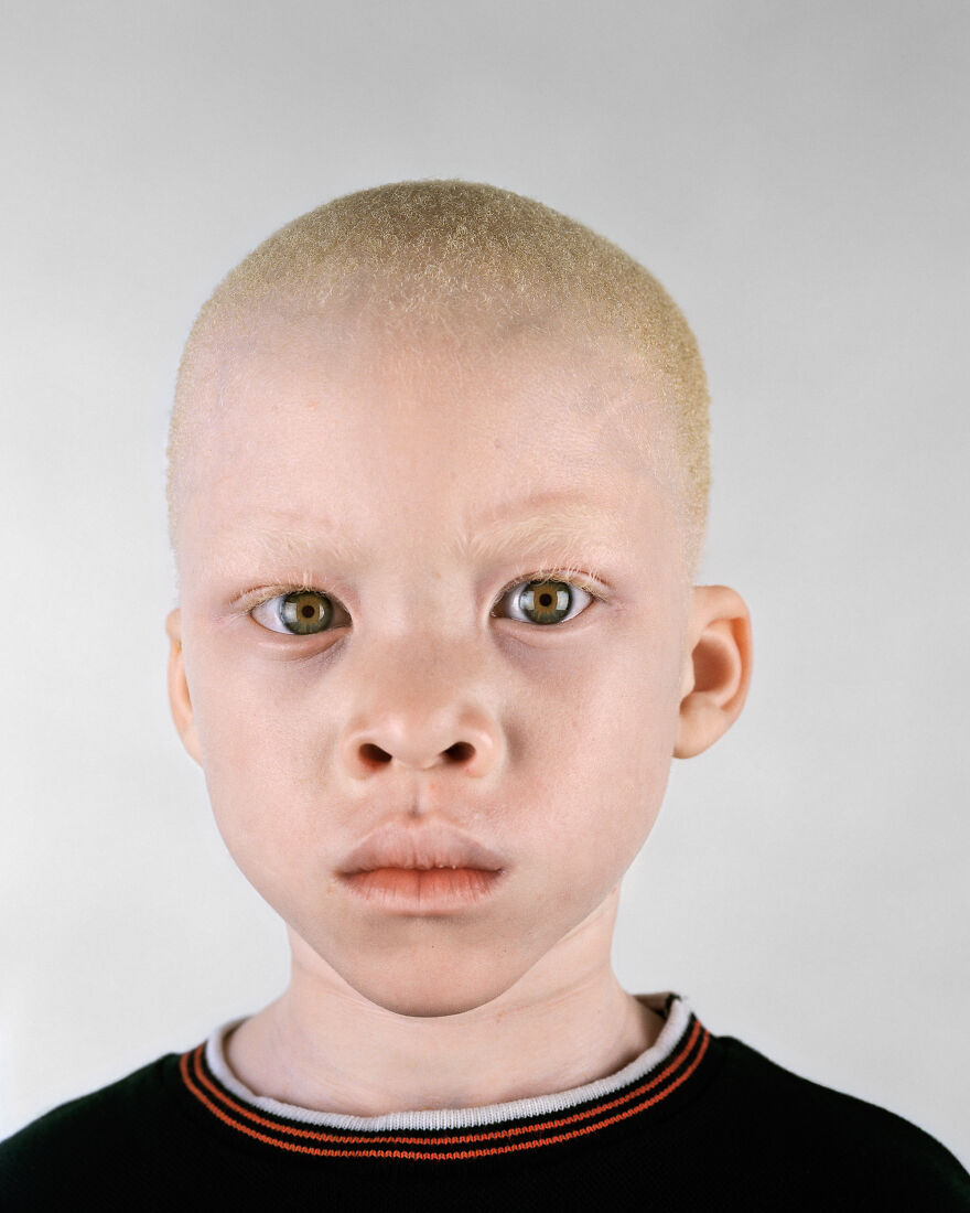 негр и азиат альбинос фото 35