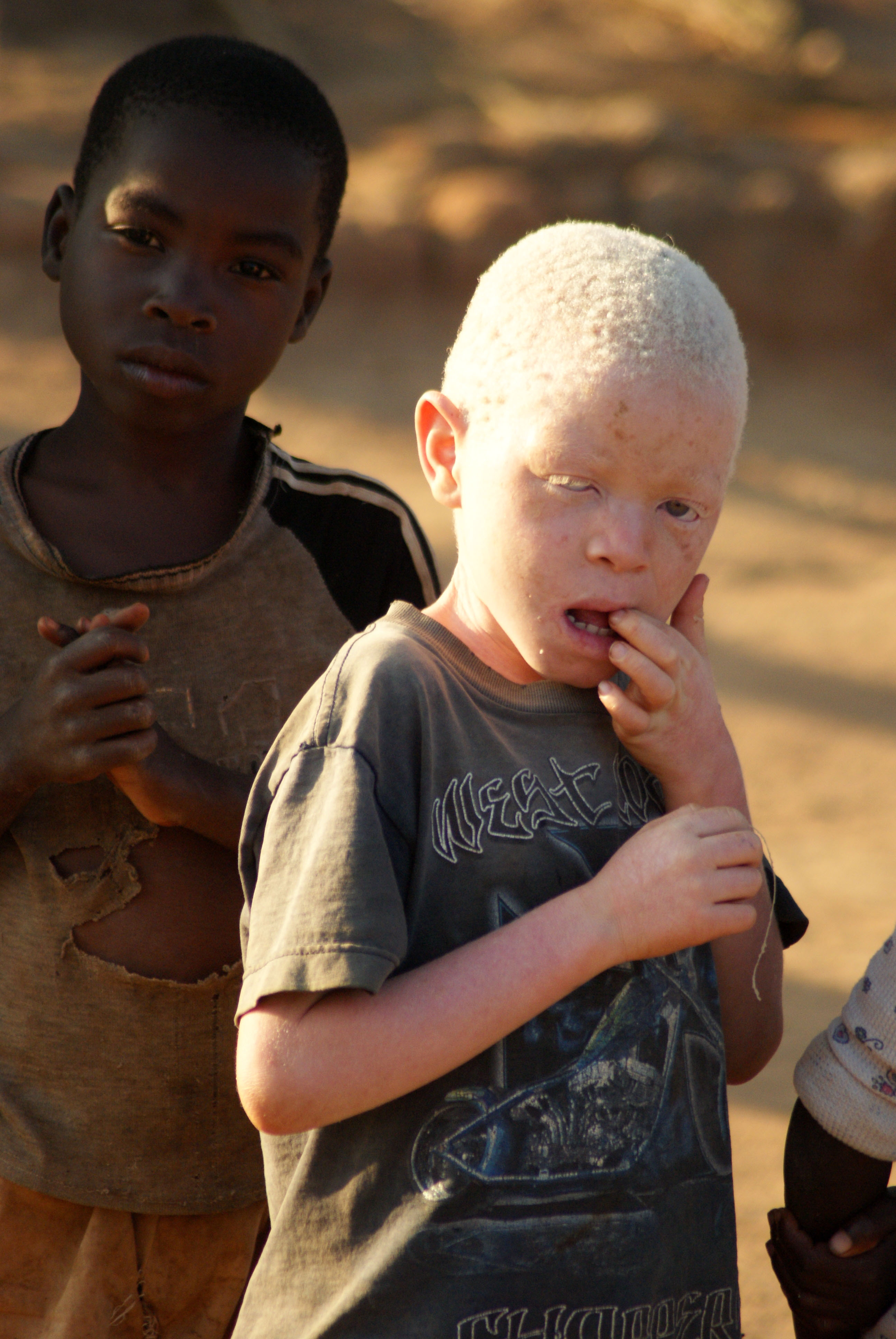 Люди альбиносы фото в африке