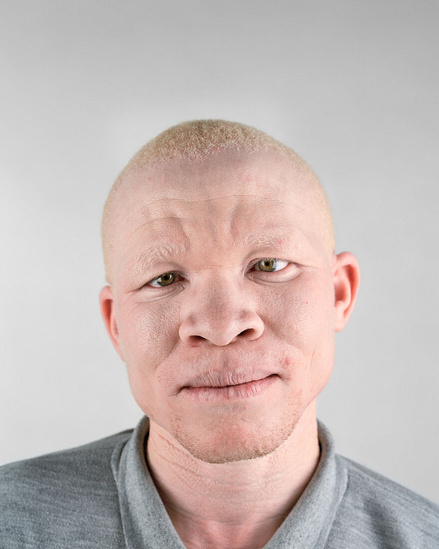 негр и азиат альбинос фото 12
