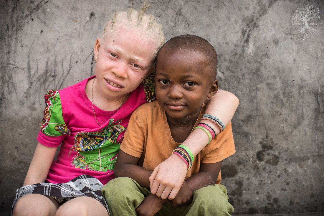 негр и азиат альбинос фото 91
