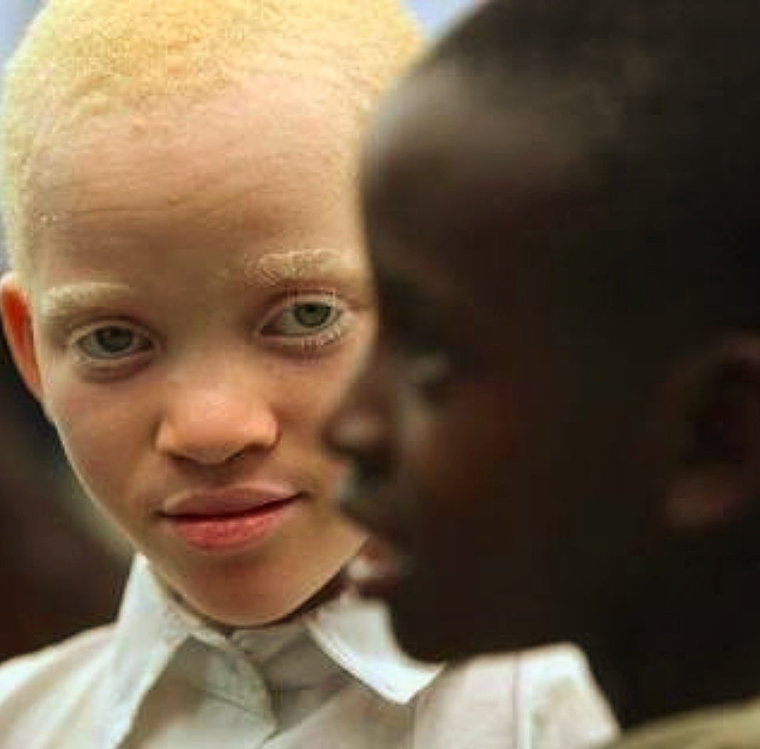 негр и азиат альбинос фото 60
