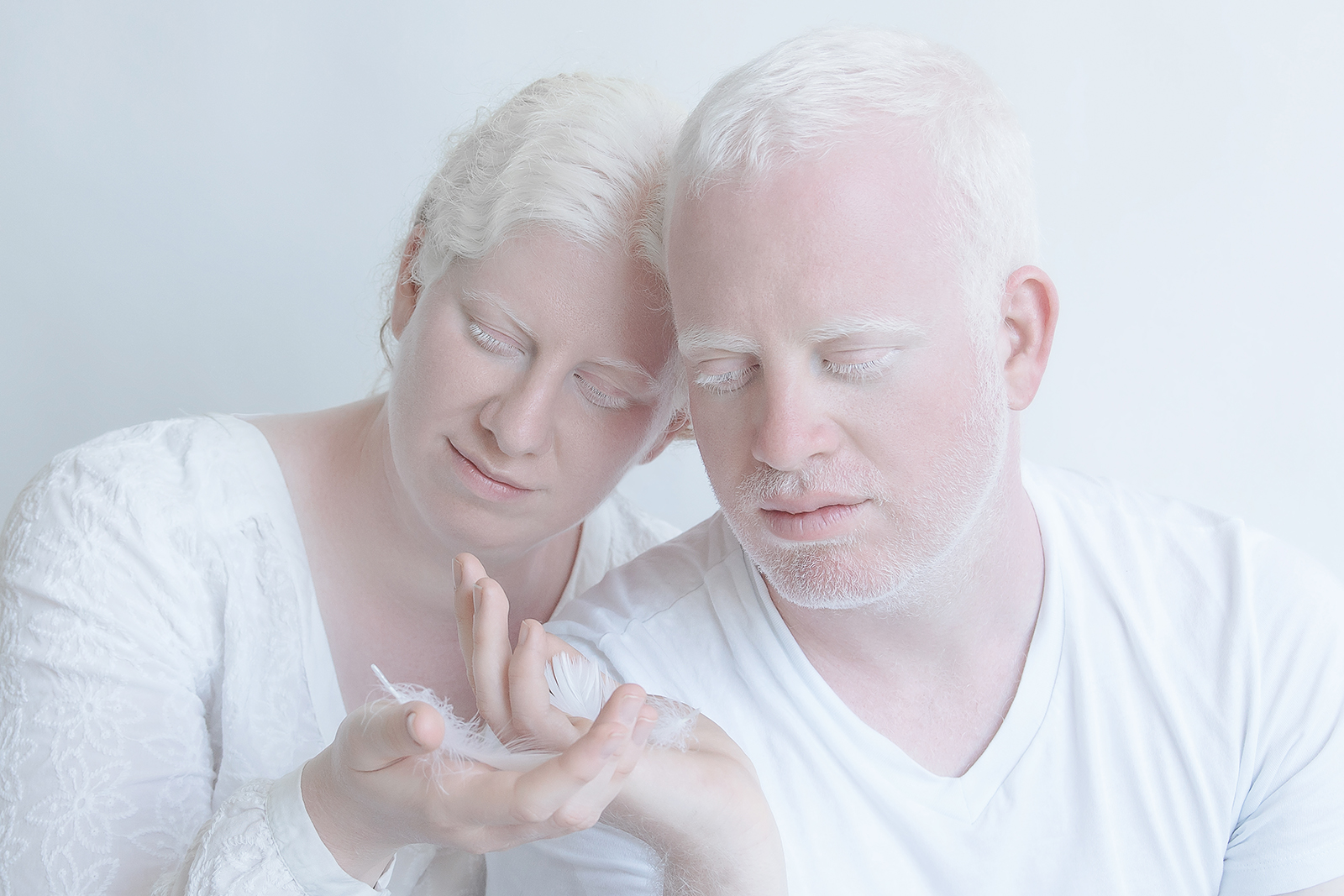 Как люди рождаются альбиносами. Тотальный альбинизм. Альбинизм хромосомная мутация. Альбинизм 1в.