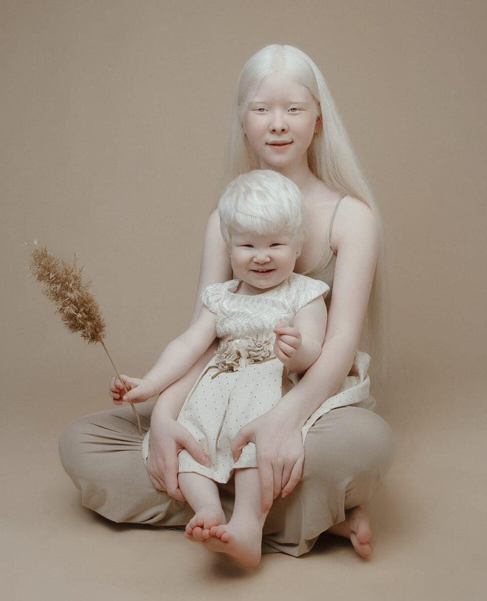 Дети альбиносы фото как выглядят