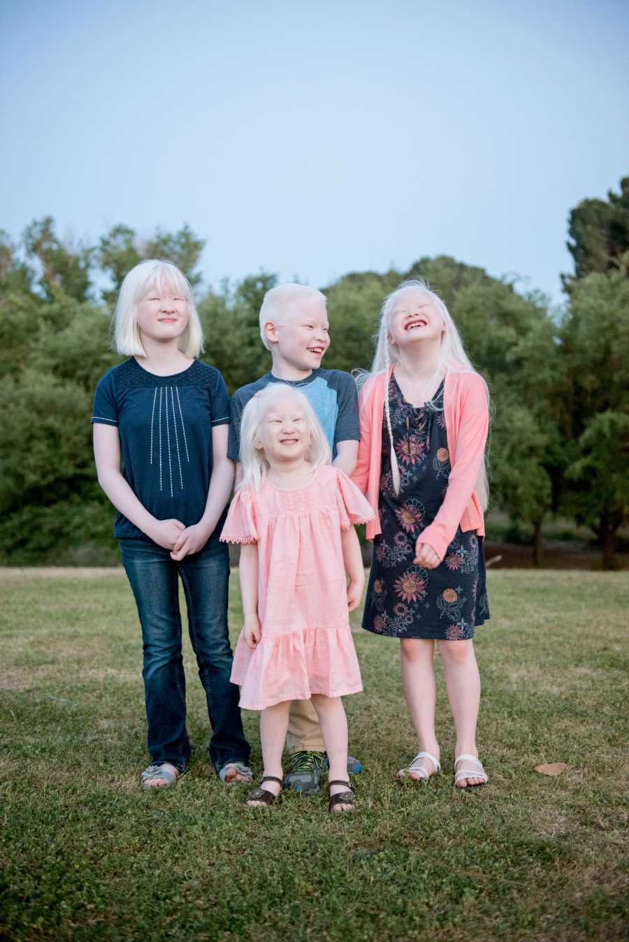 Как люди рождаются альбиносами