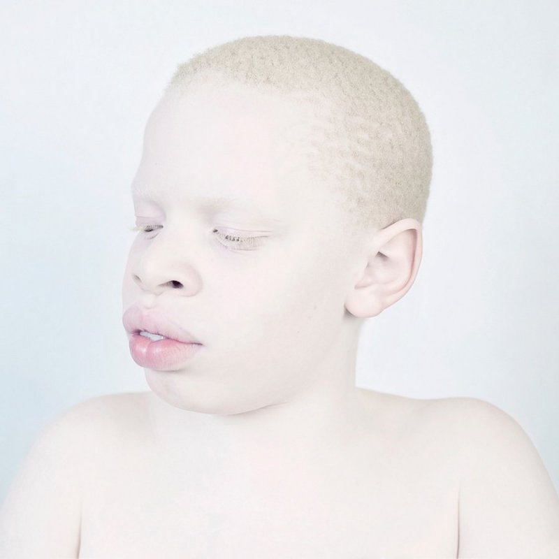 Афроазиат альбинос