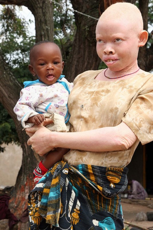 Охотники на альбиносов в Танзании