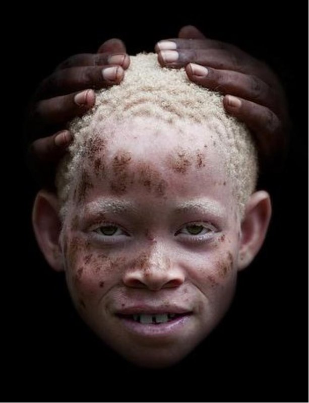 Нигер альбинос