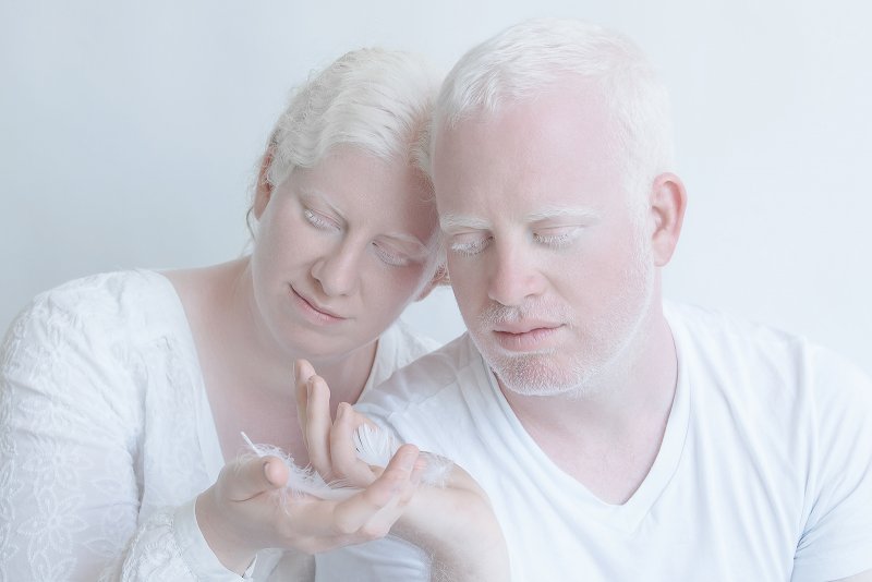 Тотальный альбинизм