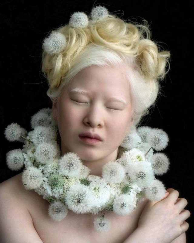 Сюэ-ли модель альбинос