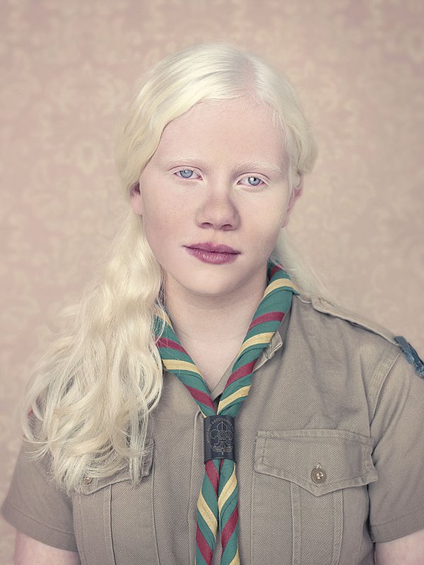 Rosie Crawford альбинос