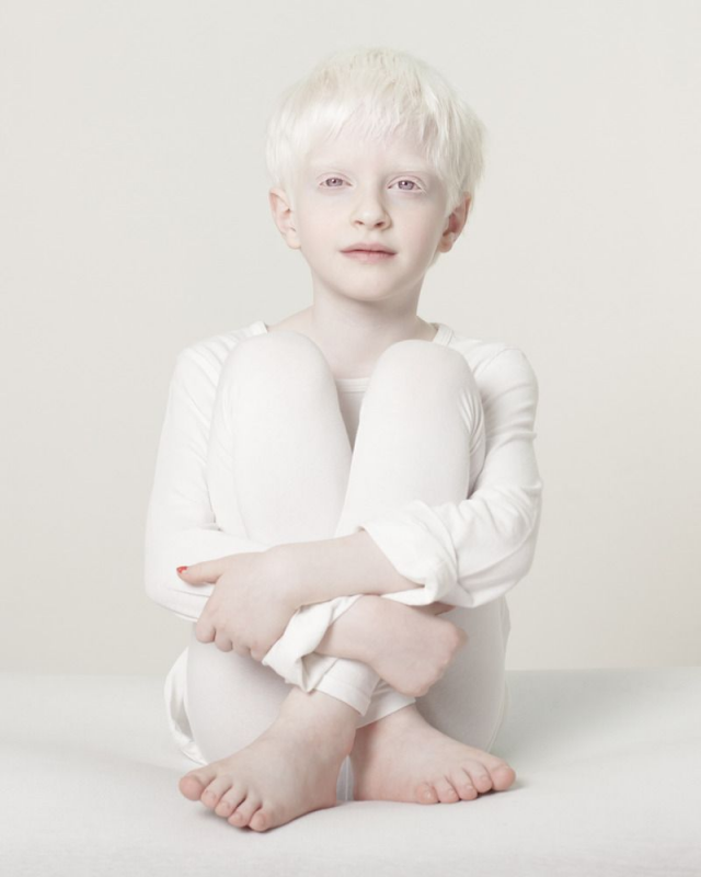Испанец альбинос