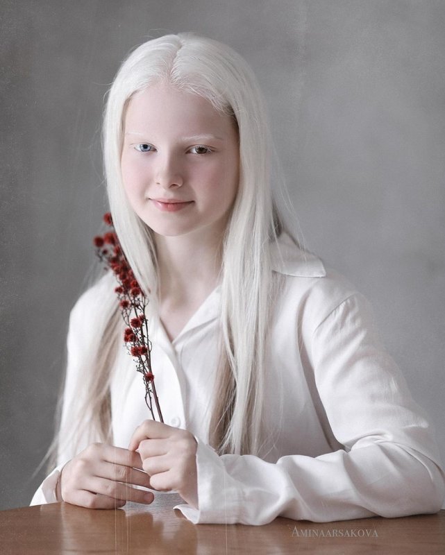 Амина Арсакаева альбинос