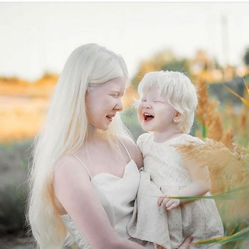 Сестры альбиносы из Казахстана Асель