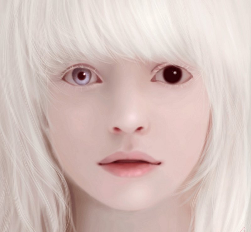Йоханна слепой альбинос