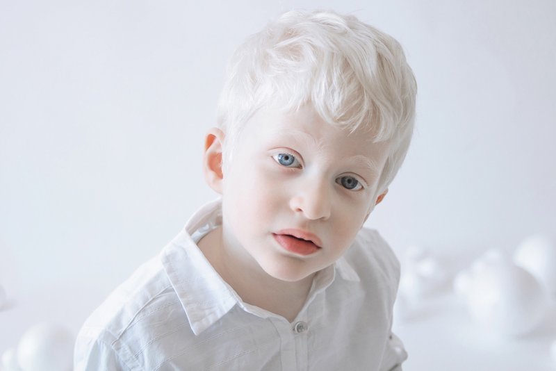 Ген альбинизма