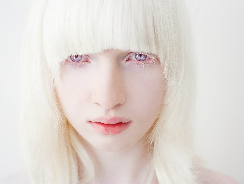 Альбинос человек фото с красными глазами