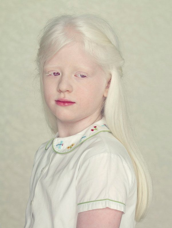 Rosie Crawford альбинос