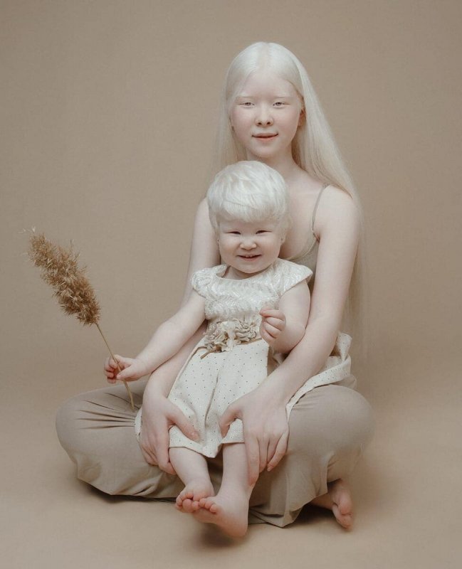 Сестры Калагановы альбиносы