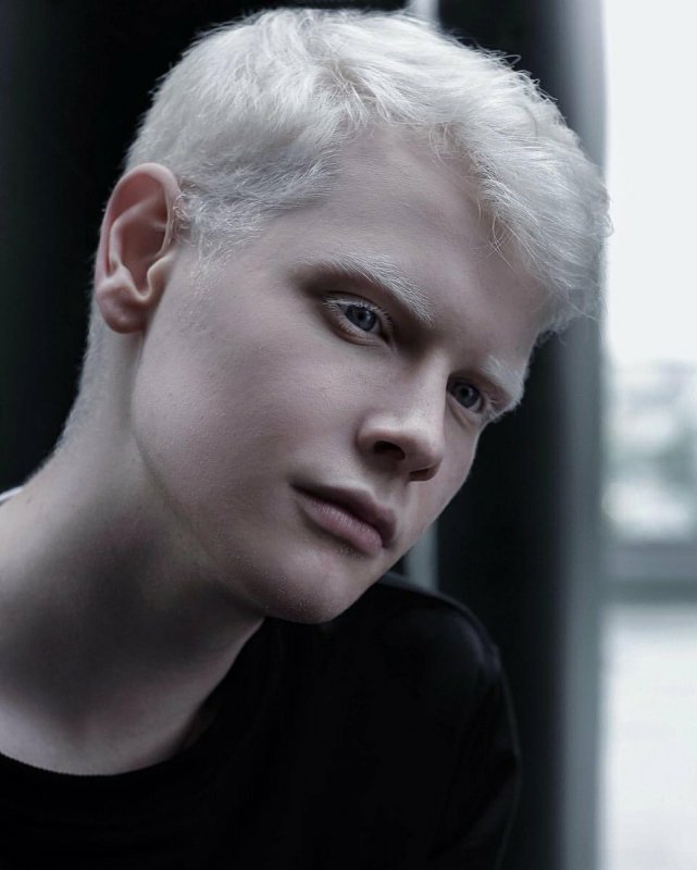 Саша альбинос