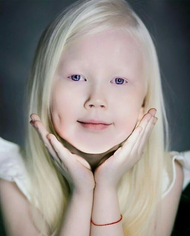 Елизавета Сорочинская альбинос
