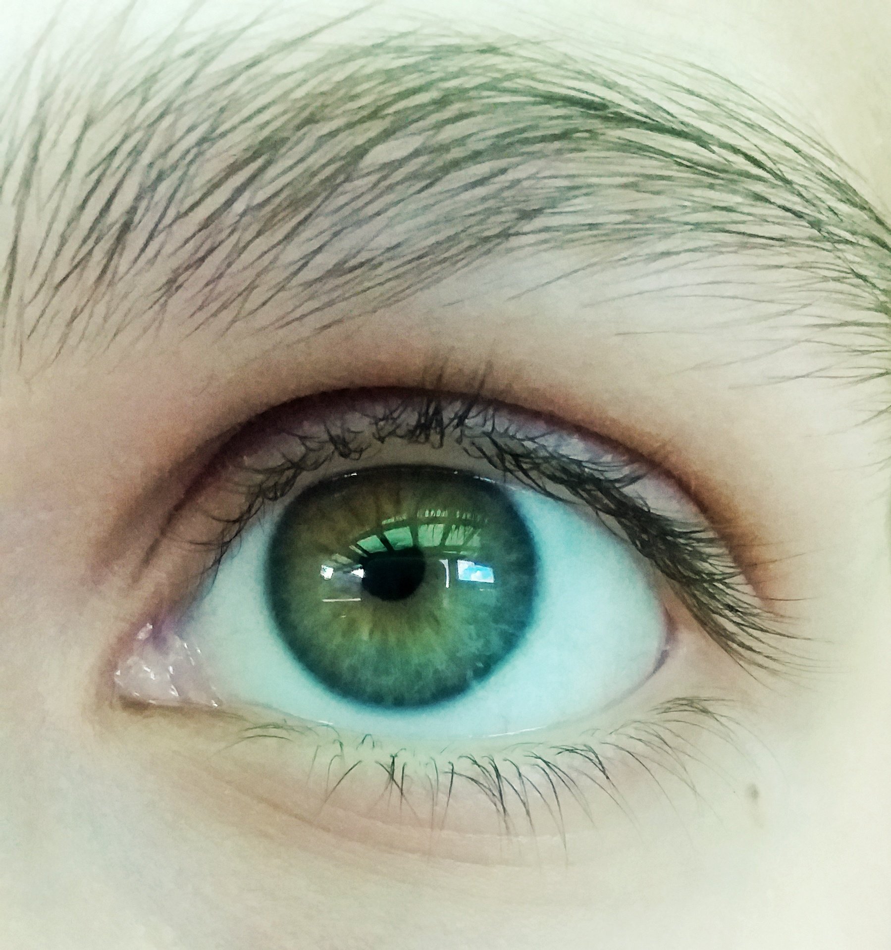 Зеленые глаза на свету. Центральная гетерохромия карих глаз. Центральная гетерохромия зеленых глаз. Центральная гетерохромия глаз Карий и зеленый. Центральная гетерохромия серо-зеленые.