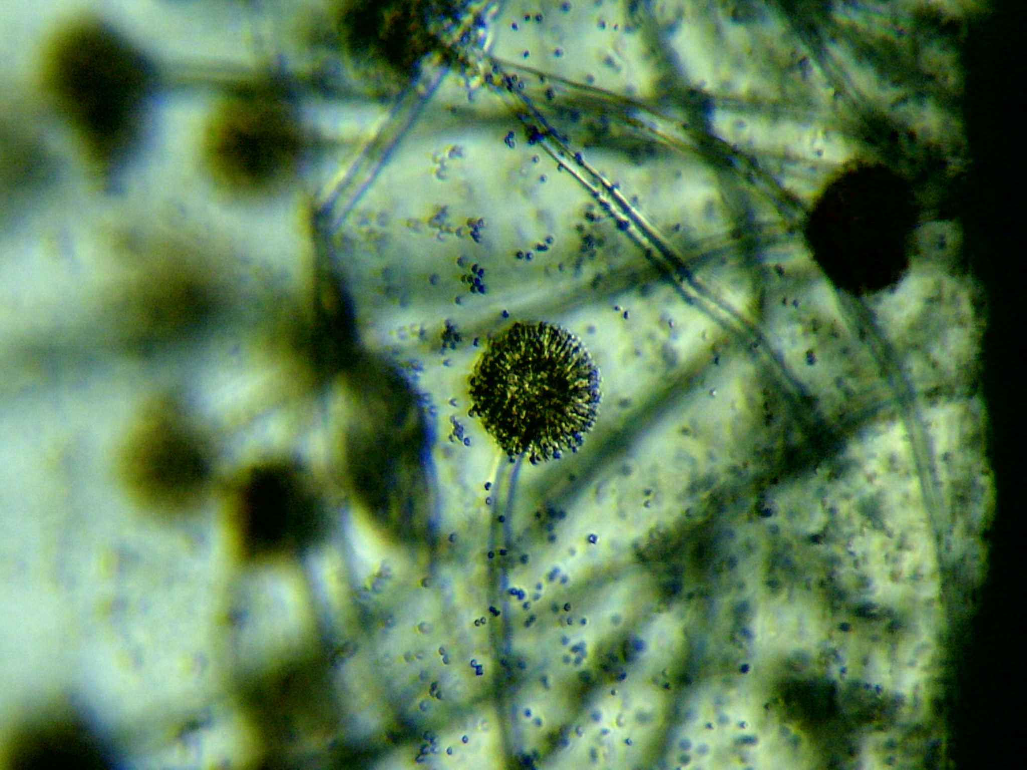 Обида микроскоп. Аспергиллус в микроскопе. Микроскопические плесневые грибы. Микроскопия плесневых грибов. Микроскопические грибы микробиология.