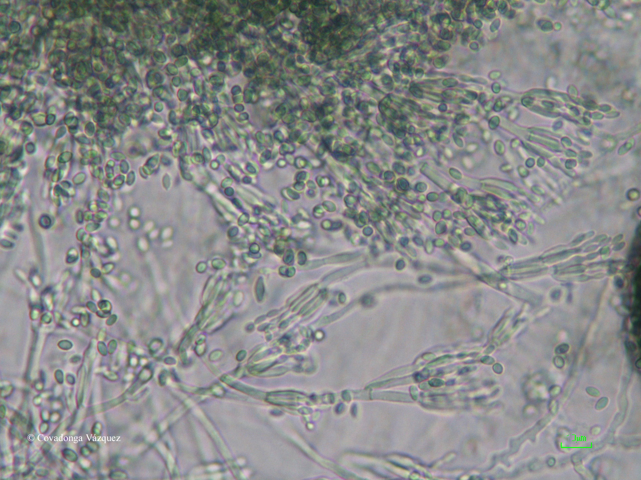 Мицелий грибов одноклеточный многоклеточный. Плесень пеницилл под микроскопом. Пеницилл микроскопия. Penicillium candidum морфология. Penicillium funiculosum.