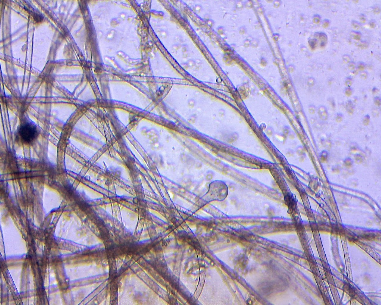 Мицелий грибов одноклеточный многоклеточный. Микроспорум плесневый гриб. Мицелий мукора под микроскопом. Мицелий аспергилла. Плесневый грибок рода Microsporum.