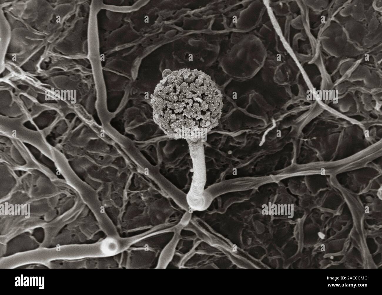 Гифы грибов под микроскопом