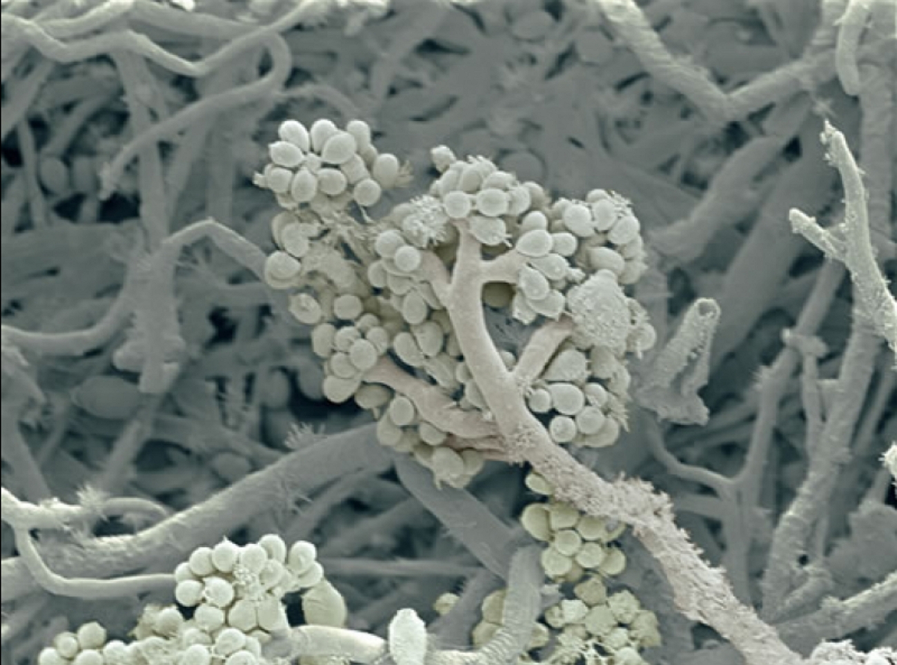 Грибы кожи под микроскопом фото