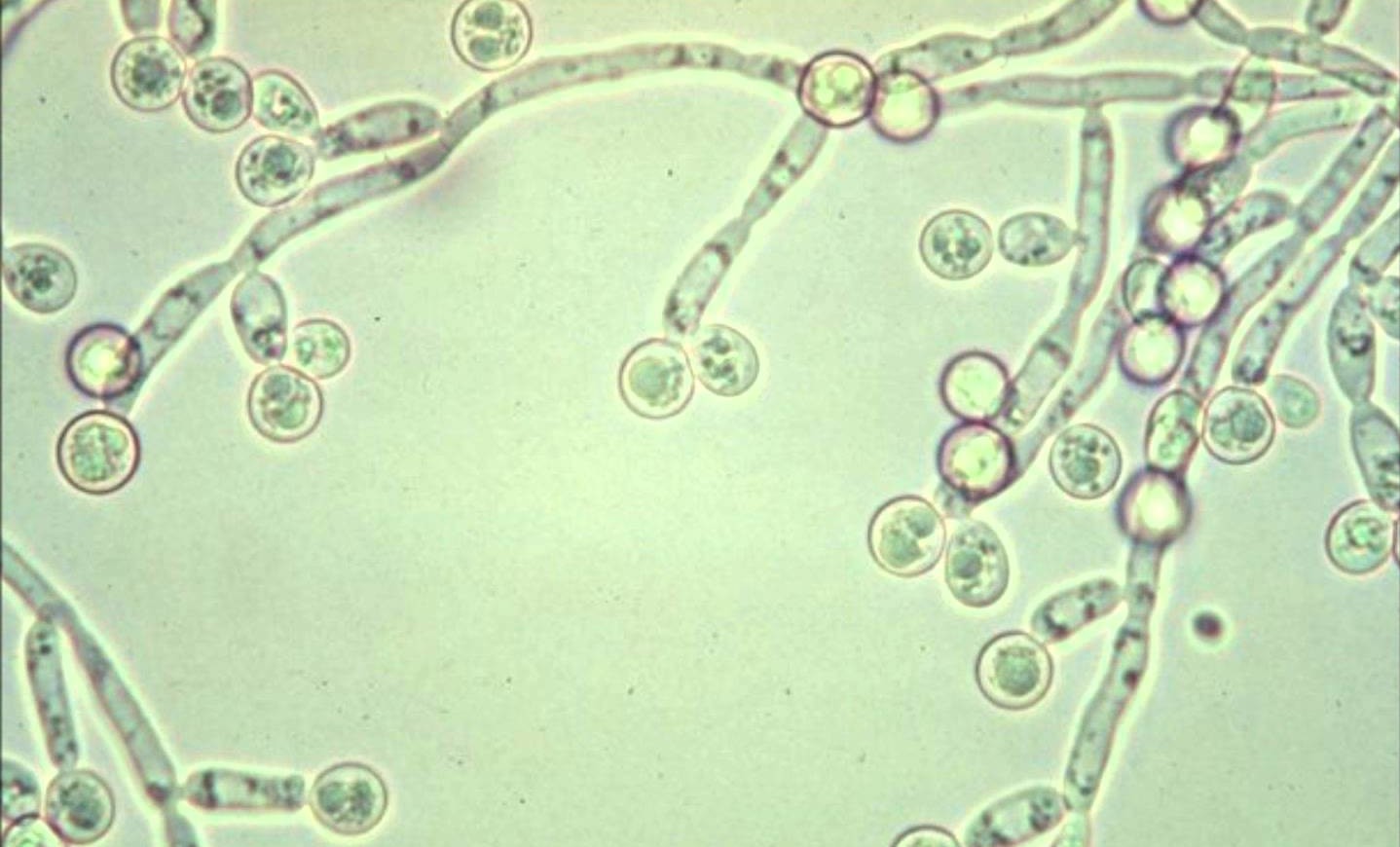Кандида альбиканс под микроскопом
