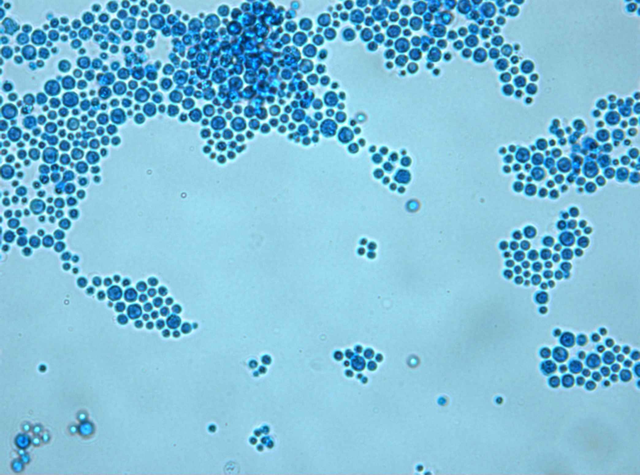 Дрожжей Saccharomyces cerevisiae микроскопия