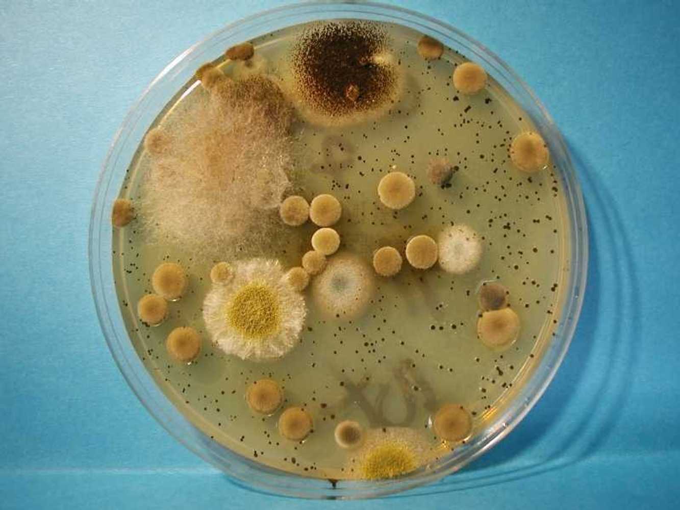 Микроскопические мицелиальные грибы. Микроскопические плесневые грибы. Одноклеточные грибы плесень. Aspergillus и Penicillium. Плесневые грибы вирусы