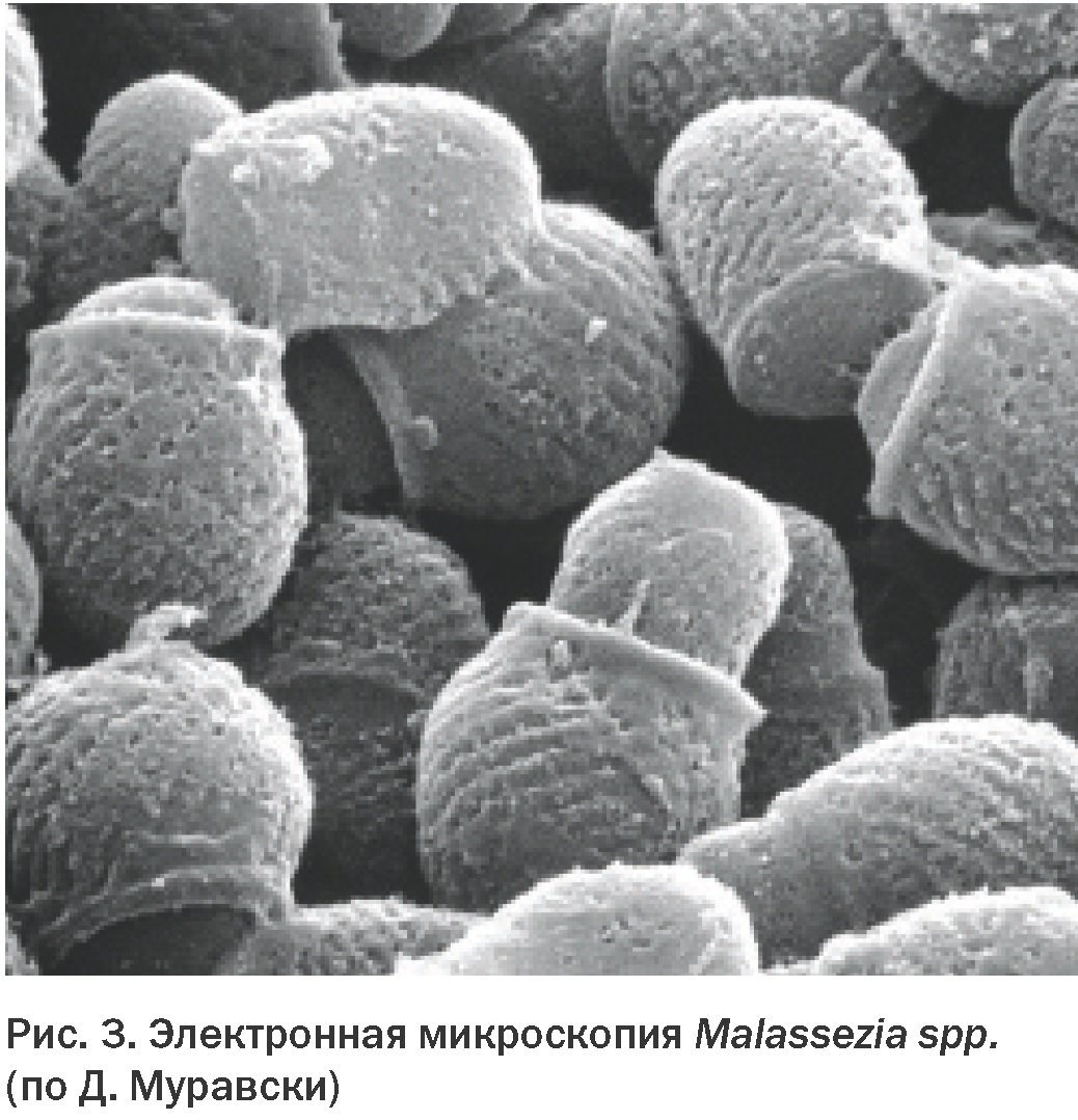 Malassezia globosa под микроскопом