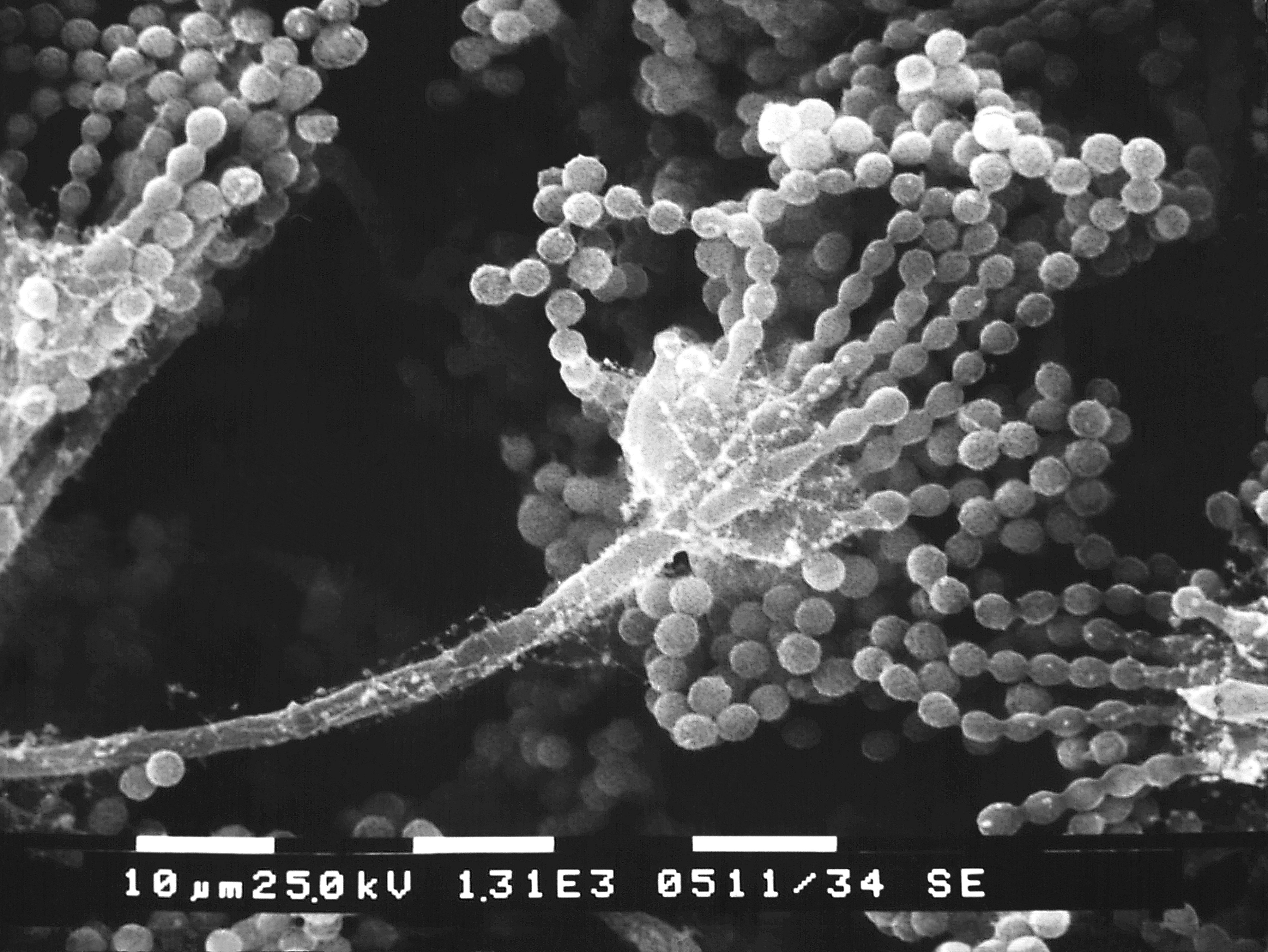 Патогенные грибы споры. Аспергилл микроскоп. Споры грибов аспергиллез. Плесневые грибы аспергиллус. Плесневые грибы аспергилл.