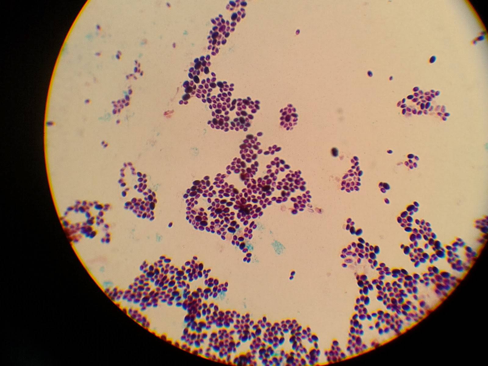 Молочница бактерии. Кандида альбиканс микроскопия. Кандида альбиканс микросоп. Грибы кандида микроскопия. Грибы альбиканс кандида микробиология.