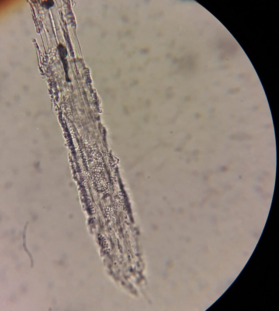 Микроспория в микроскопе