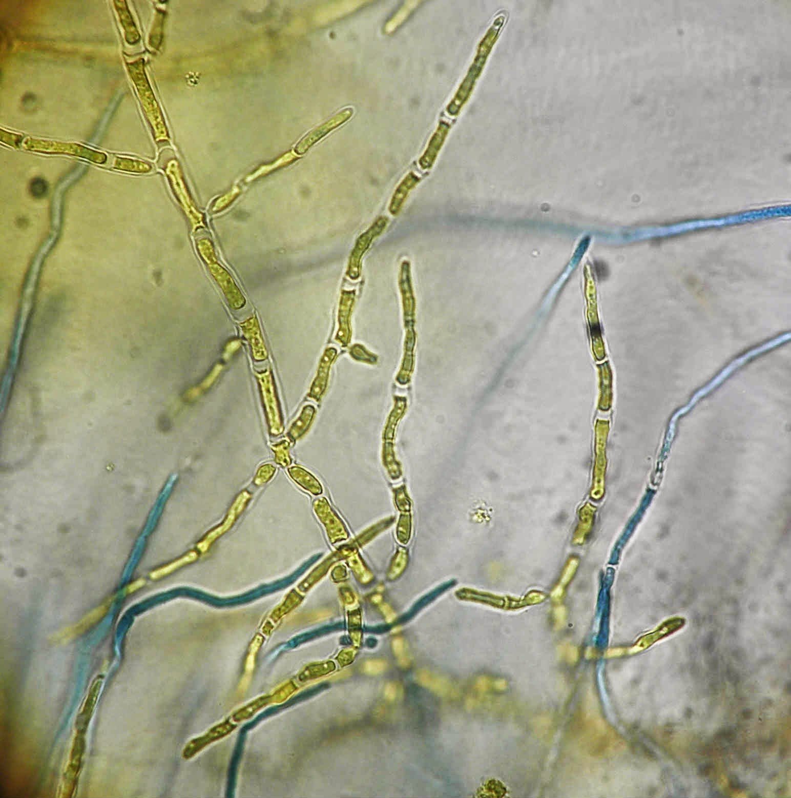 Споры гриба и нити. Микроскопия Trichophyton rubrum. Микроскопия Trichophyton verrucosum.