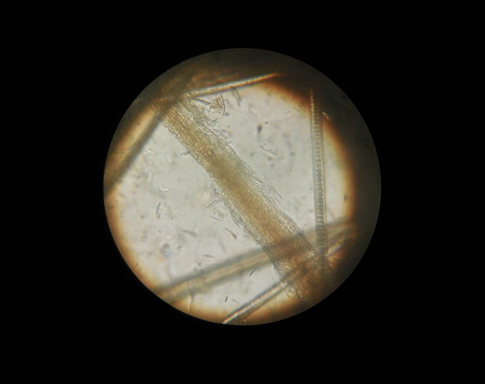 Микроспория под микроскопом у кошек