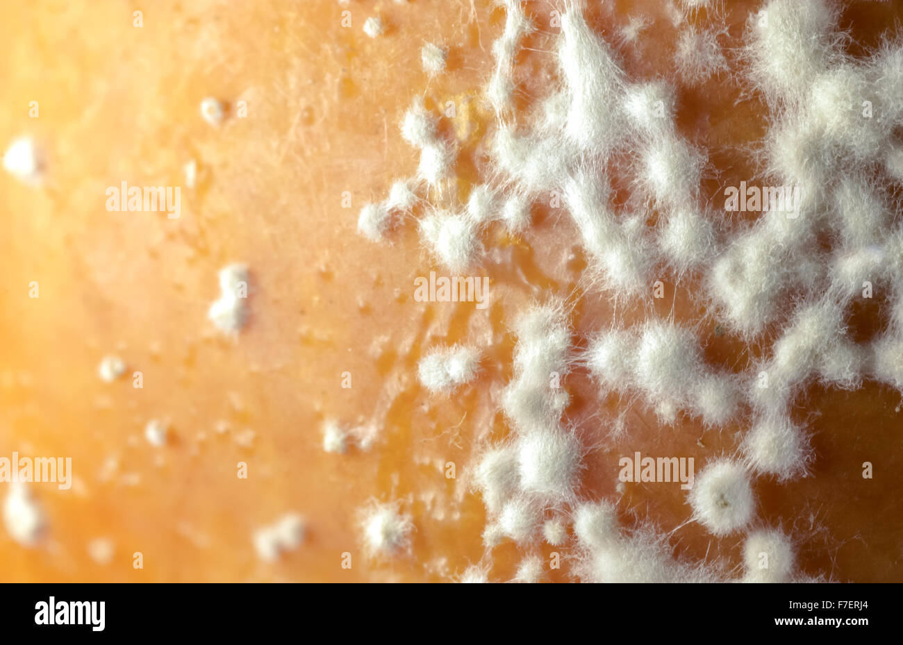 грибок кожи на теле лечение фото