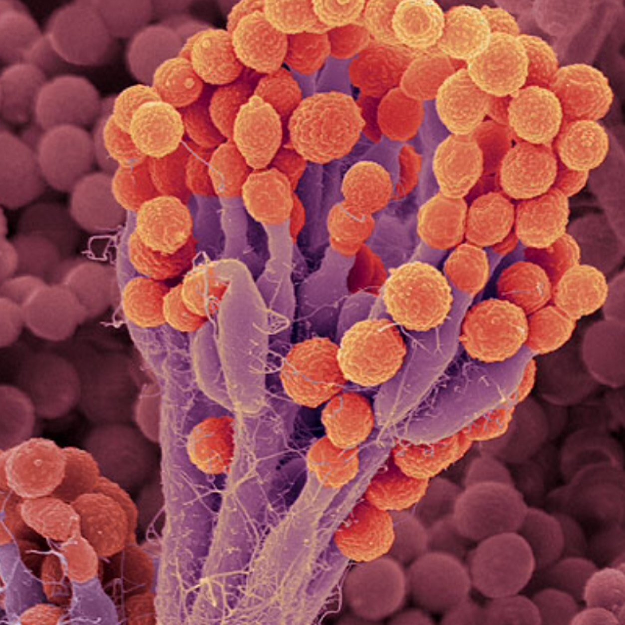 Грибы споры в организме. Пенициллиум нотатум. Гриб пеницилл в микроскопе. Грибы микроорганизмы кандиды. Пенициллин микроскопия.