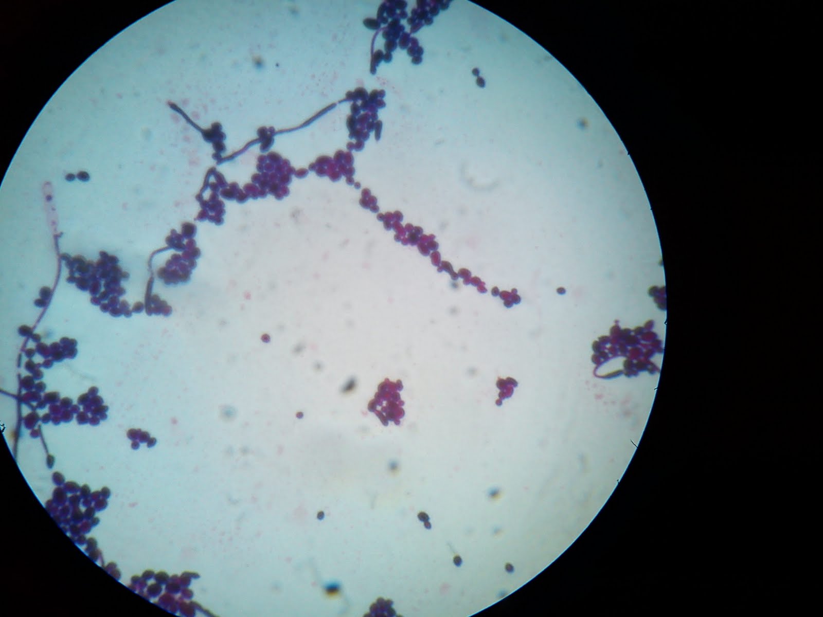 Молочница гриб. Кандида альбиканс под микроскопом. Грибы кандида микроскопия. Грибы кандида альбиканс микроскопия. Грибок рода кандида под микроскопом.