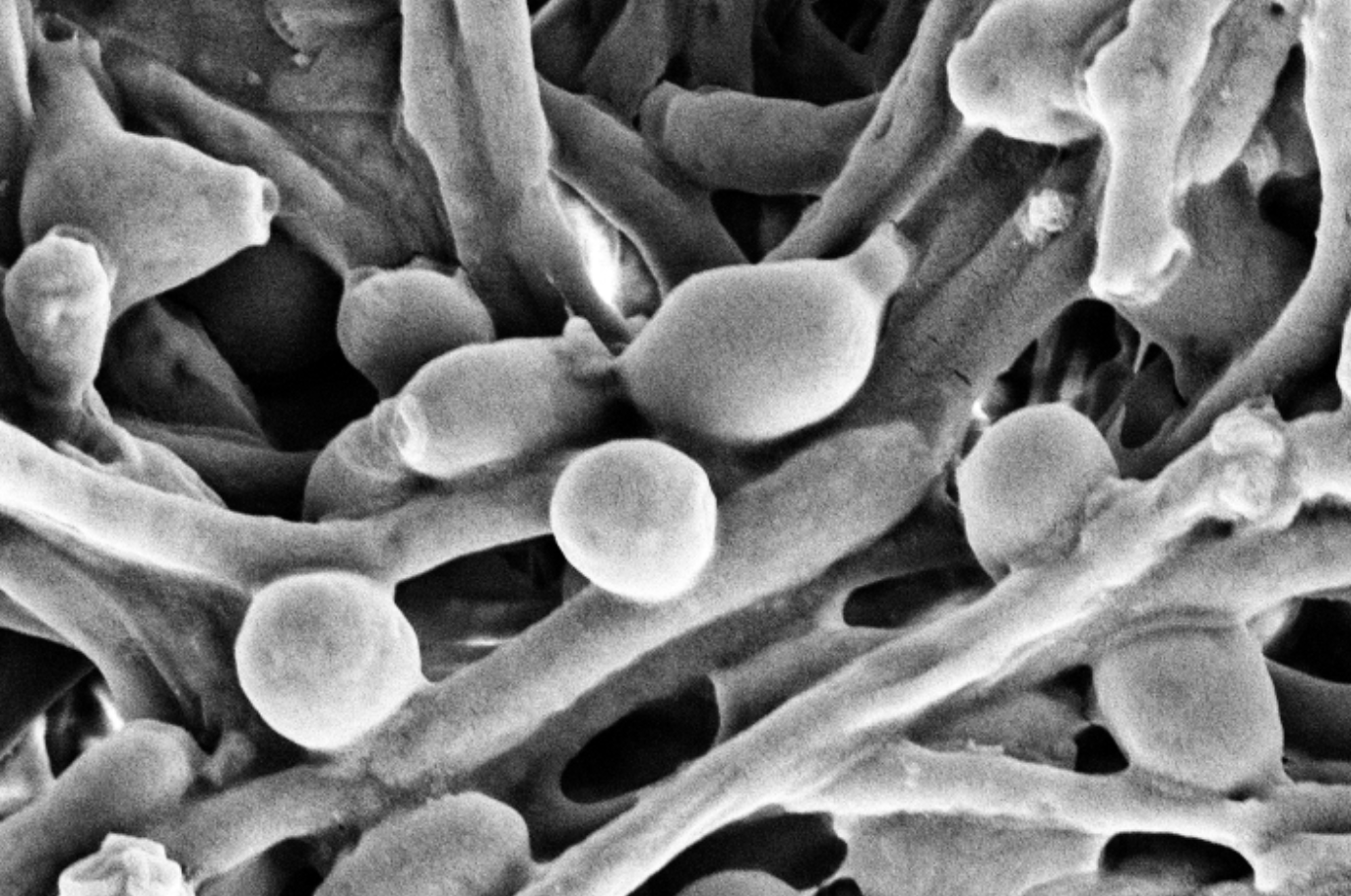 Молочница бактерии. Кандида альбиканс под микроскопом. Кандида альбиканс в полости рта.