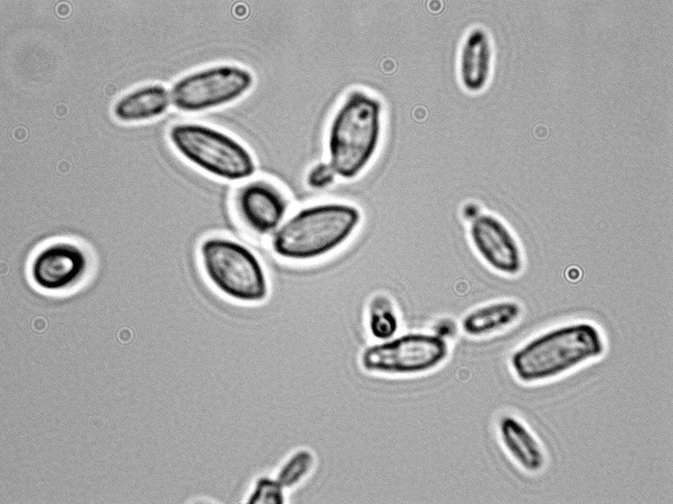 Дрожжи дикие и культурные. Дрожжи Saccharomyces cerevisiae. Дрожжей Saccharomyces cerevisiae микроскопия. Дрожжи Saccharomyces микроскопия. Дрожжи Saccharomyces под микроскопом.