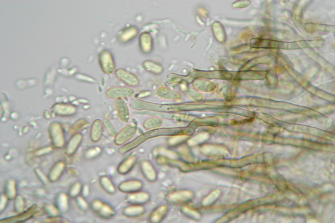 Споры грибов под микроскопом фото
