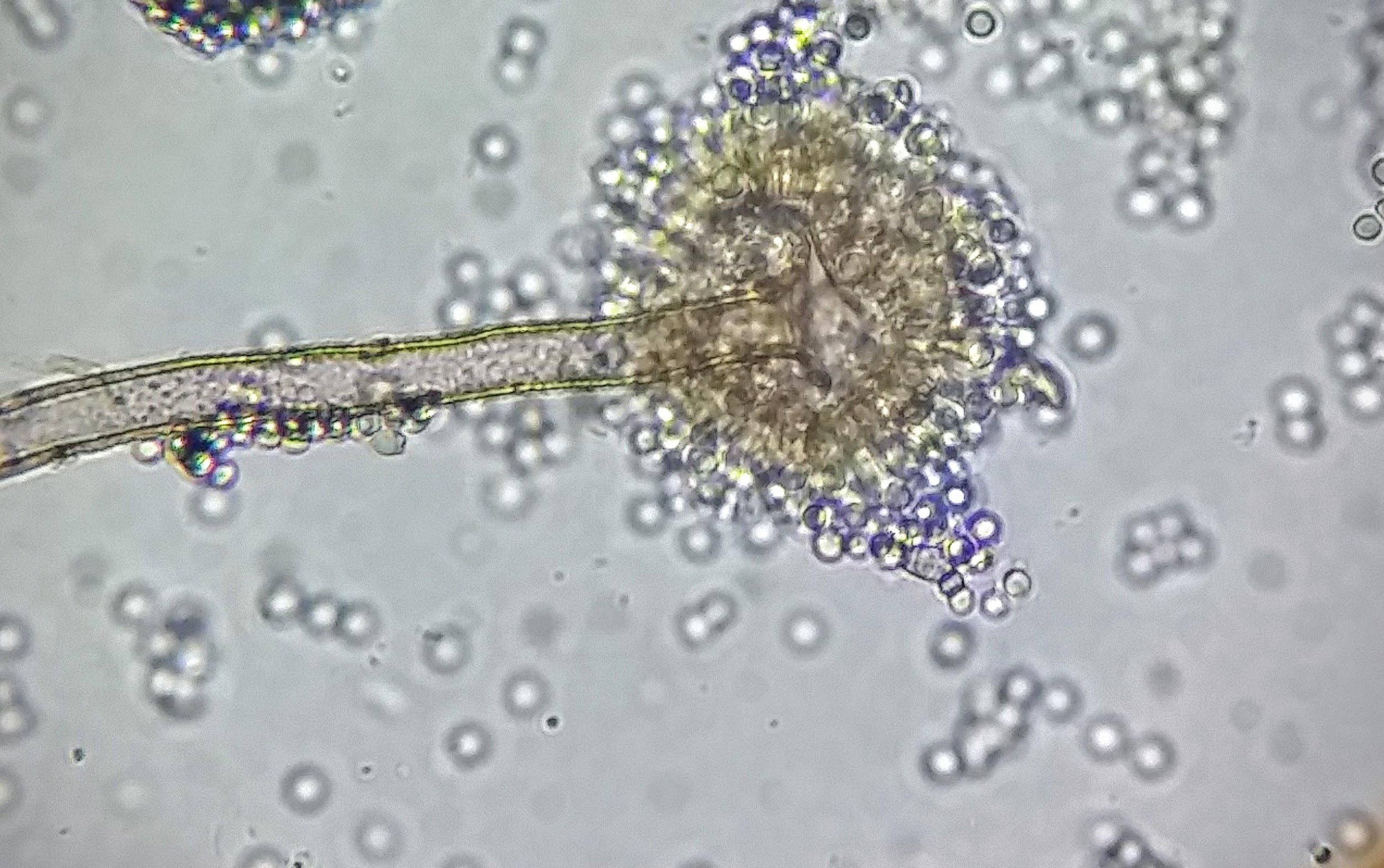 Вирус споры грибов. Плесневые грибы аспергиллус. Аспергилл flavus. Плесневые грибы аспергилл. Aspergillus flavus под микроскопом.