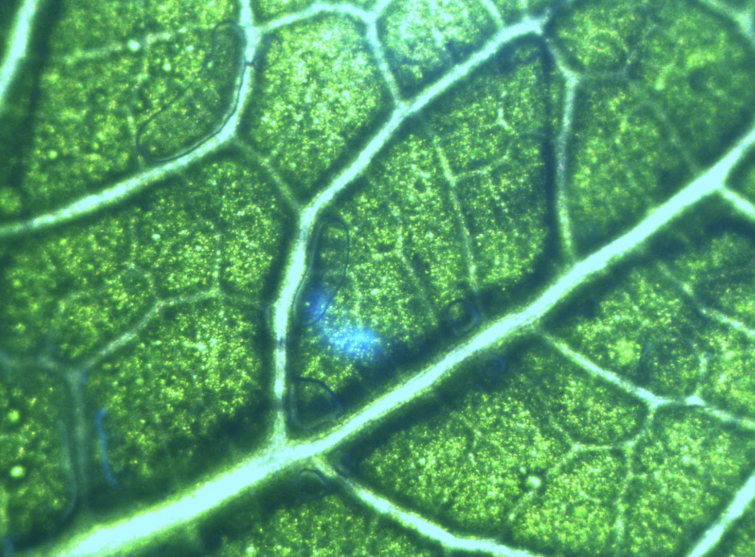 Хлоропласты микроскоп. Хлорофилл в клетках растения. Хлорофилл лист растения под микроскопом. Клетка хлорофилл под микроскопом. Хлорофилл под микроскопом.