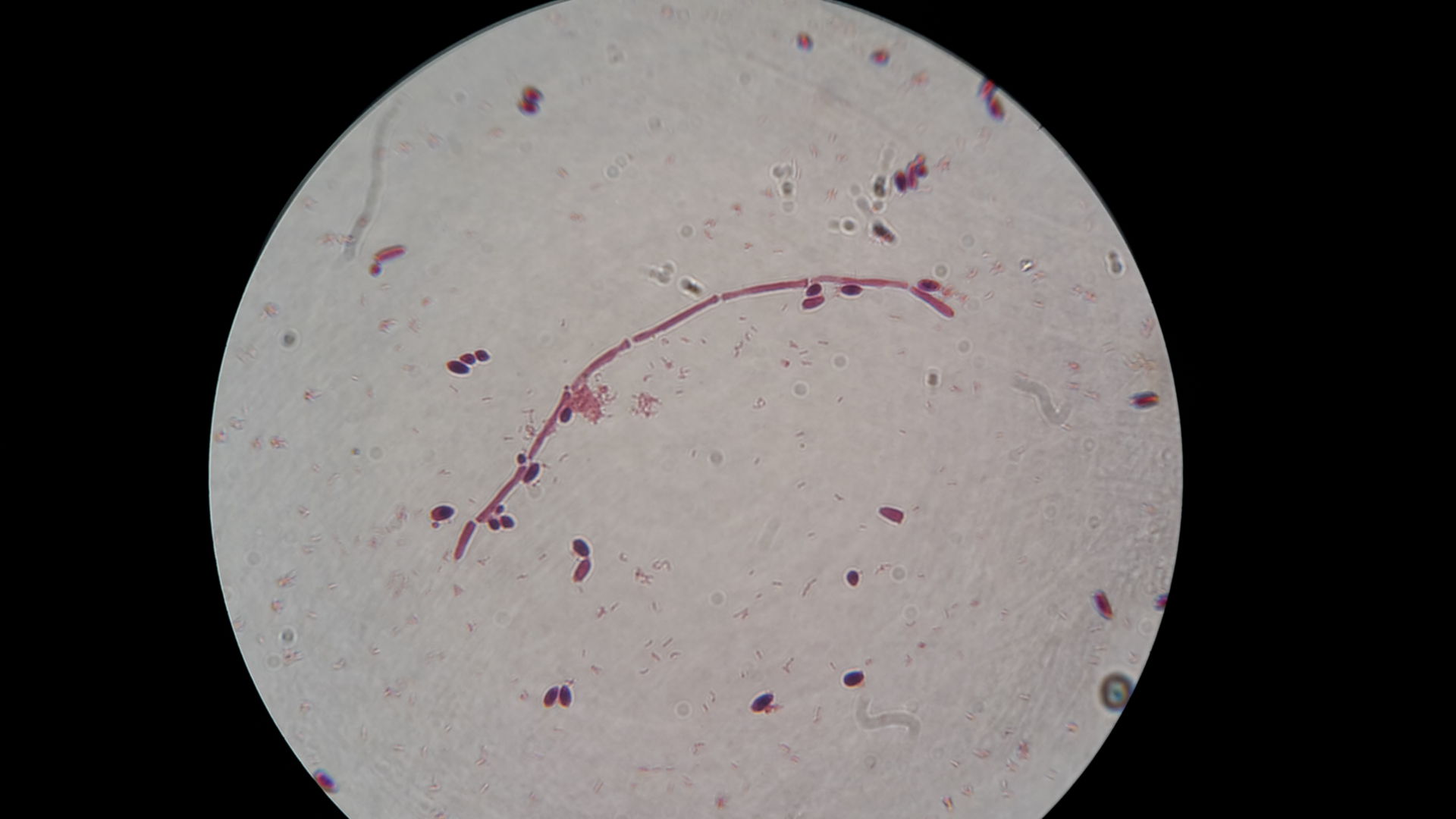 Кандида альбиканс микроскопия