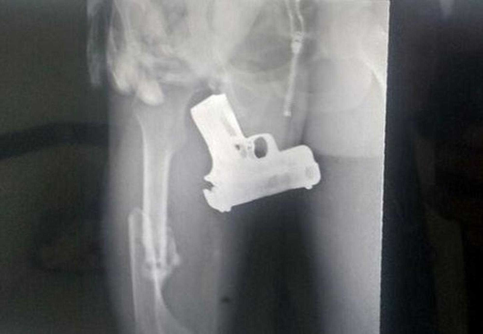 Рентгеновский снимок с пистолетом